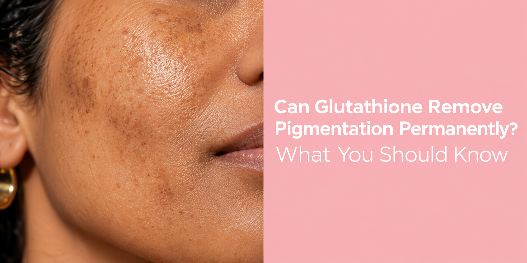 Can Glutathione Remove Pigmentation Permanently? – NOURRIR