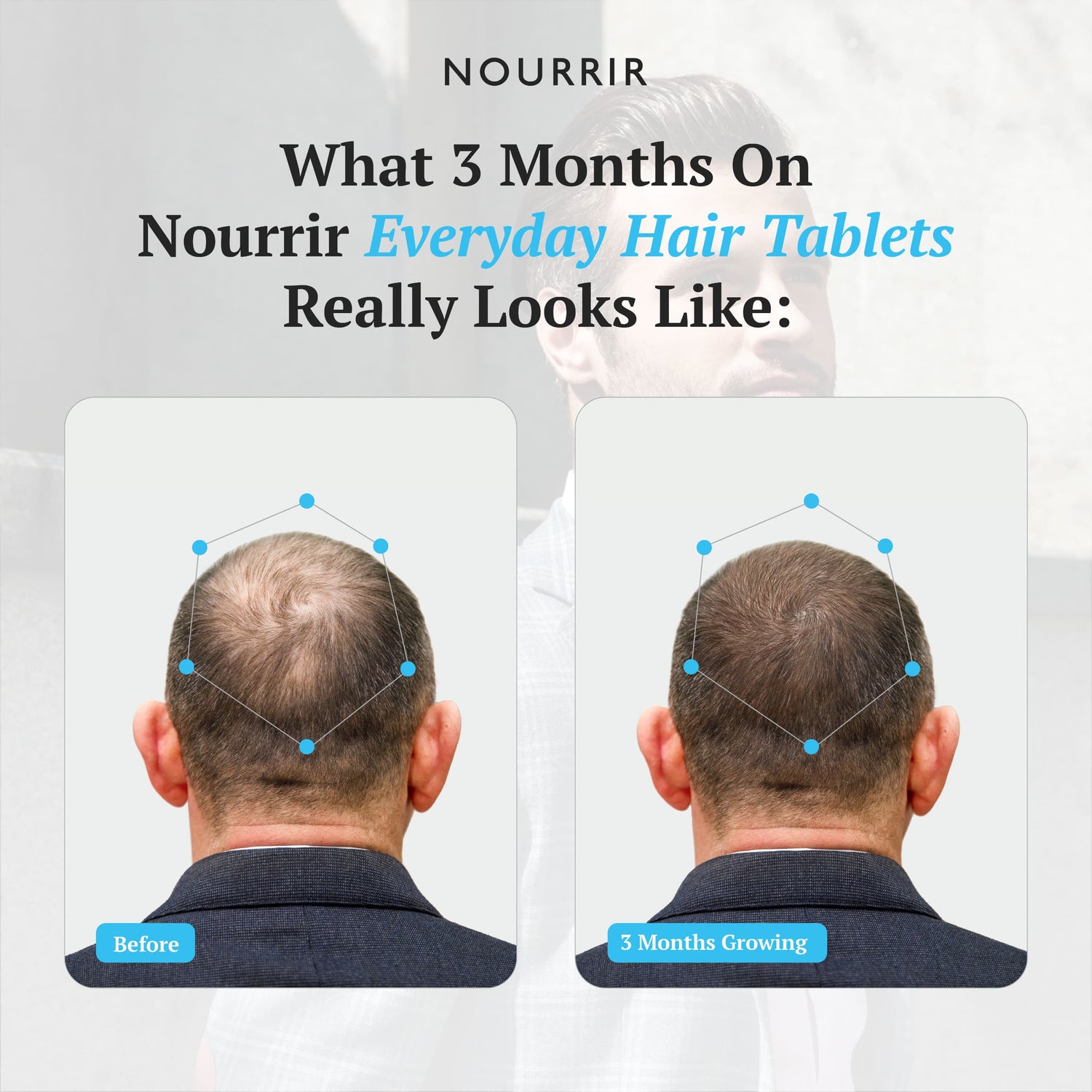 Everyday Hair Health Tablets (Male) - For Hair Growth & Hairfall Reduction