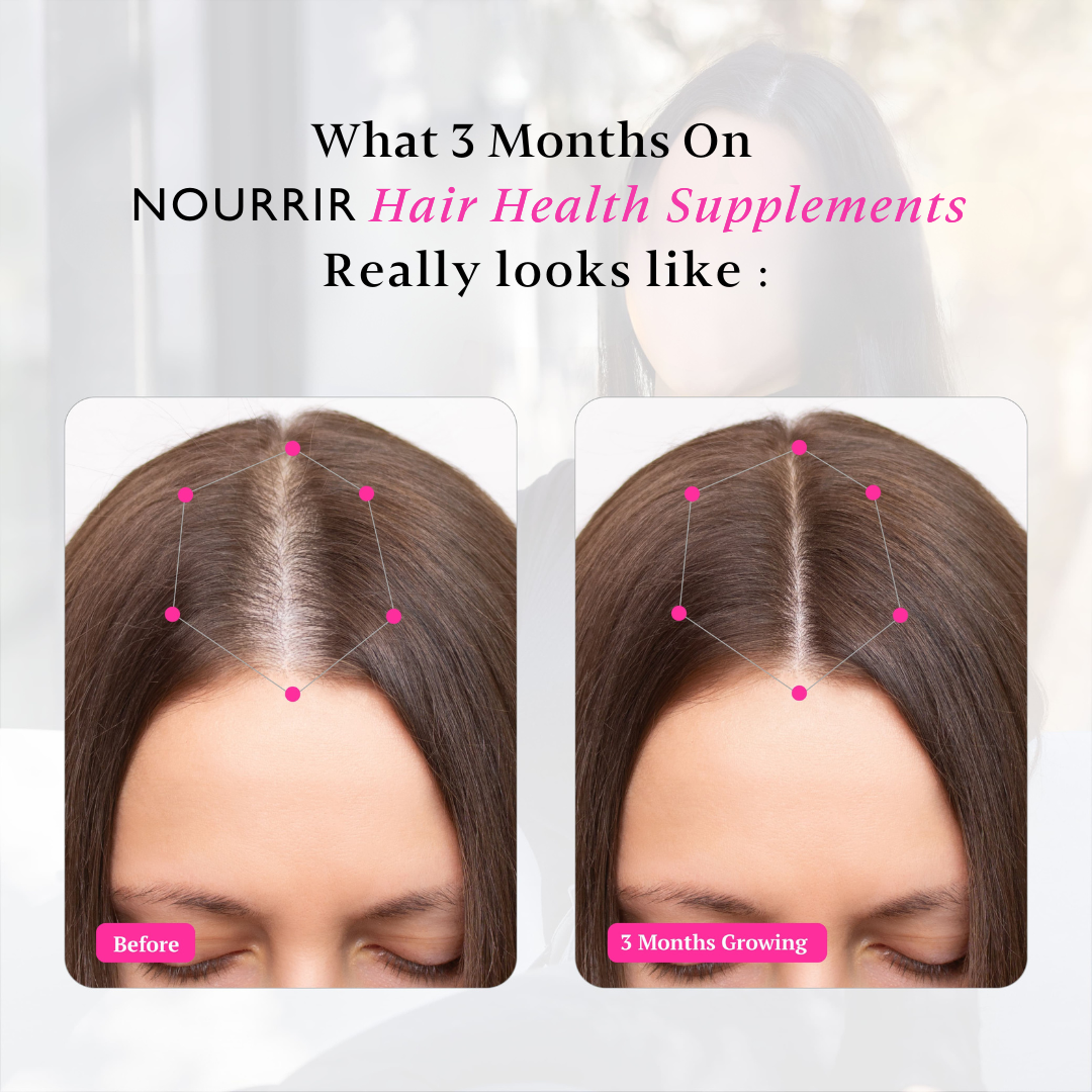 Everyday Hair Health Tablets (Female) - For Hair Growth & Reduction in Hair Fall