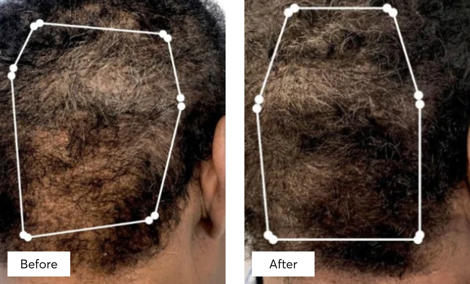 Before & After