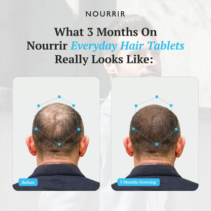 Everyday Hair Health Tablets (Male) - For Hair Growth &amp; Hairfall Reduction