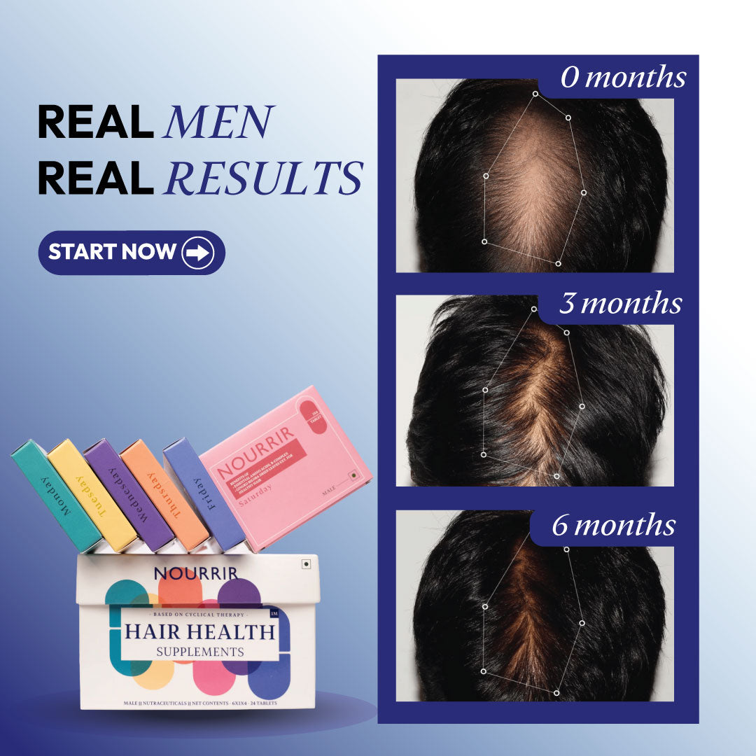 Hair Health Supplements - Male