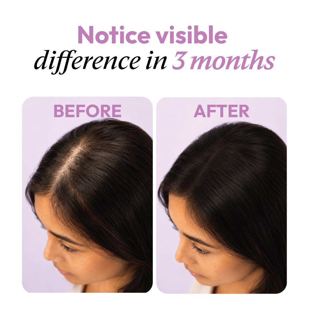 NOURRIR Everyday Hair Growth Serum