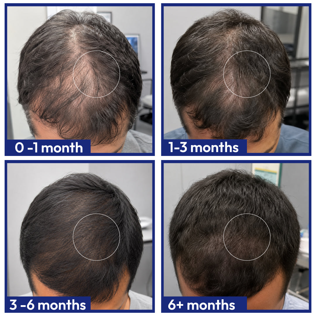 Hair Health Supplements - Male