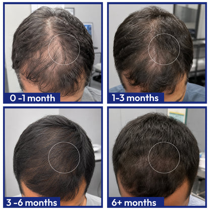 Hair Health Supplements - Male