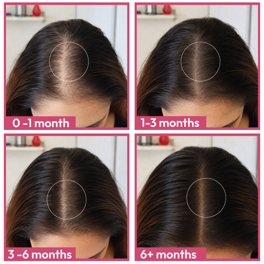 Hair Health Supplements - Female