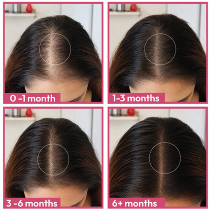 Hair Health Supplements - Female