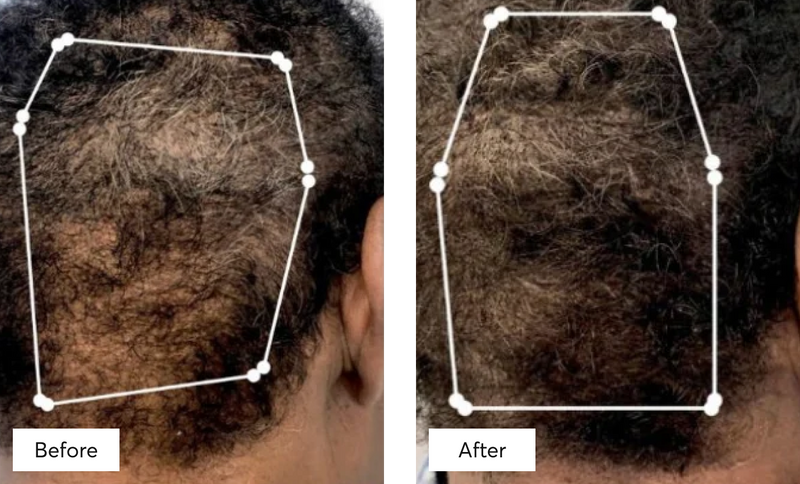 Before & After